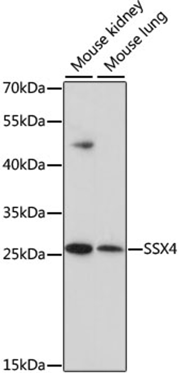 Western blot analysis of extracts of various cell lines using SSX4 Polyclonal Antibody at dilution of 1:1000.