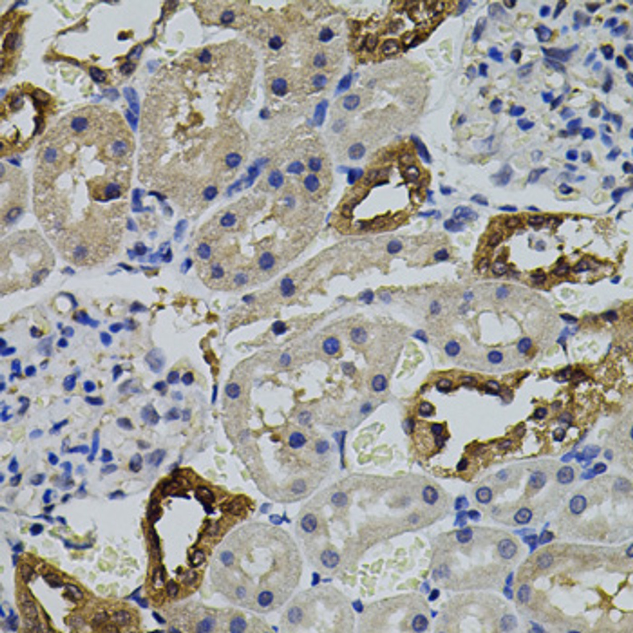 Immunohistochemistry of paraffin-embedded Rat kidney using AURKC Polyclonal Antibody