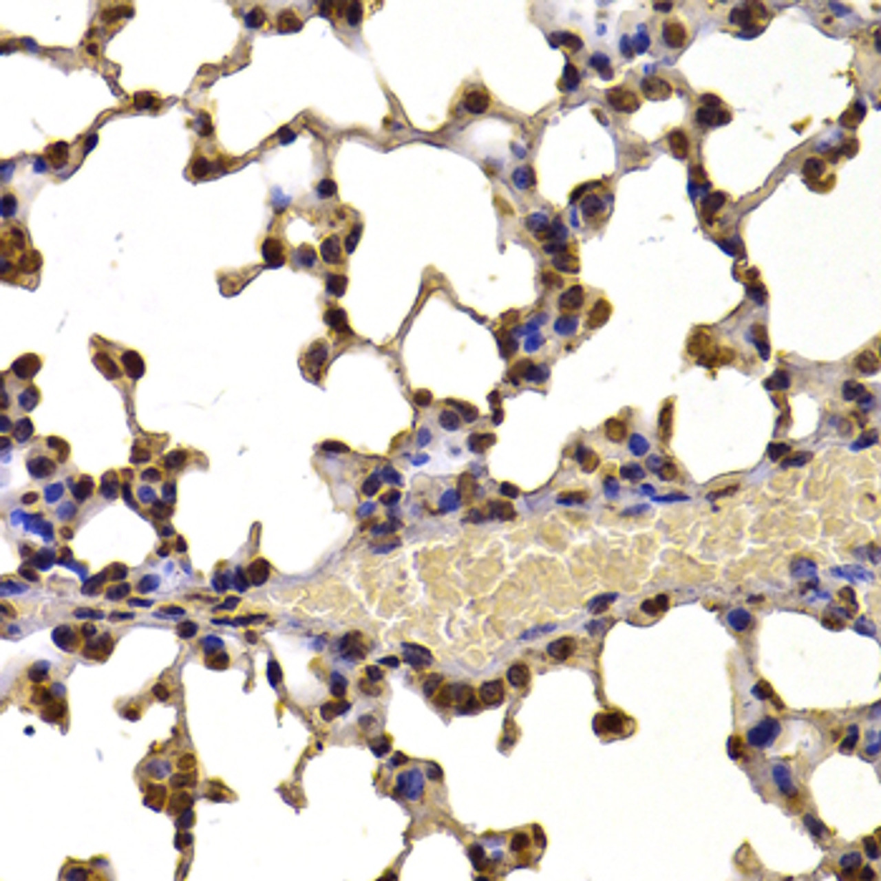 Immunohistochemistry of paraffin-embedded Mouse lung using WHSC1 Polyclonal Antibody at dilution of  1:100 (40x lens).