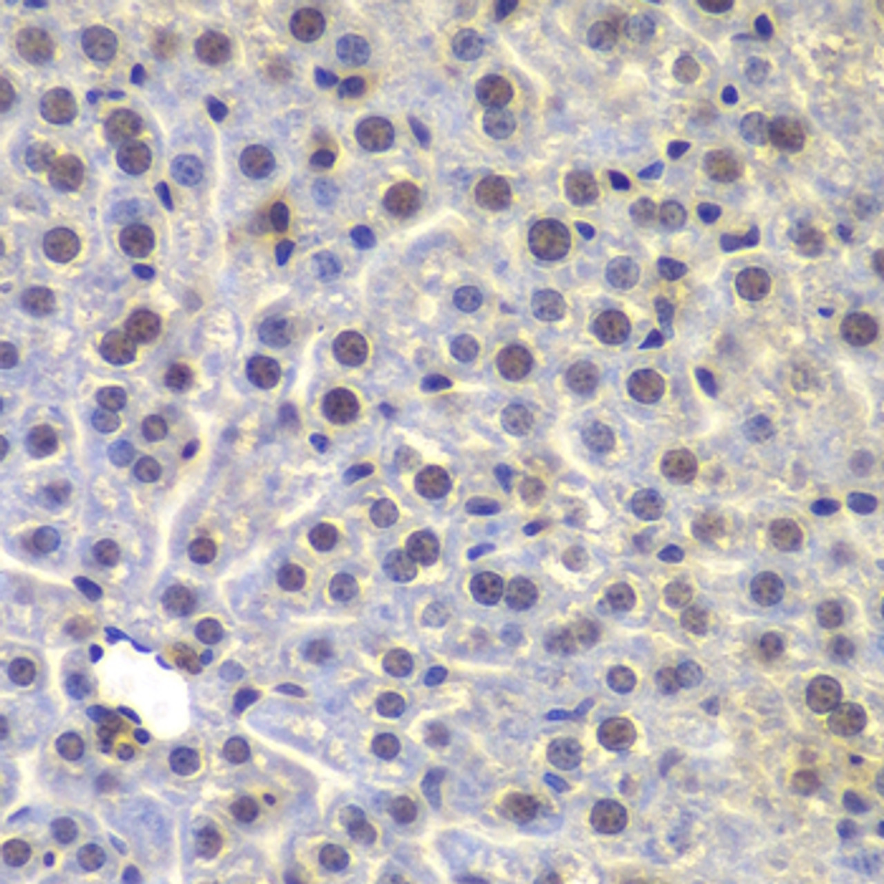 Immunohistochemistry of paraffin-embedded Mouse liver using FUBP3 Polyclonal Antibody at dilution of  1:100 (40x lens).