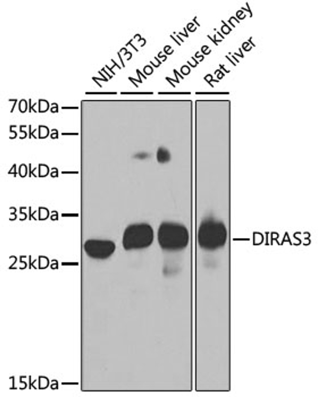 Western blot analysis of extracts of various cell lines using DIRAS3 Polyclonal Antibody at dilution of 1:1000.