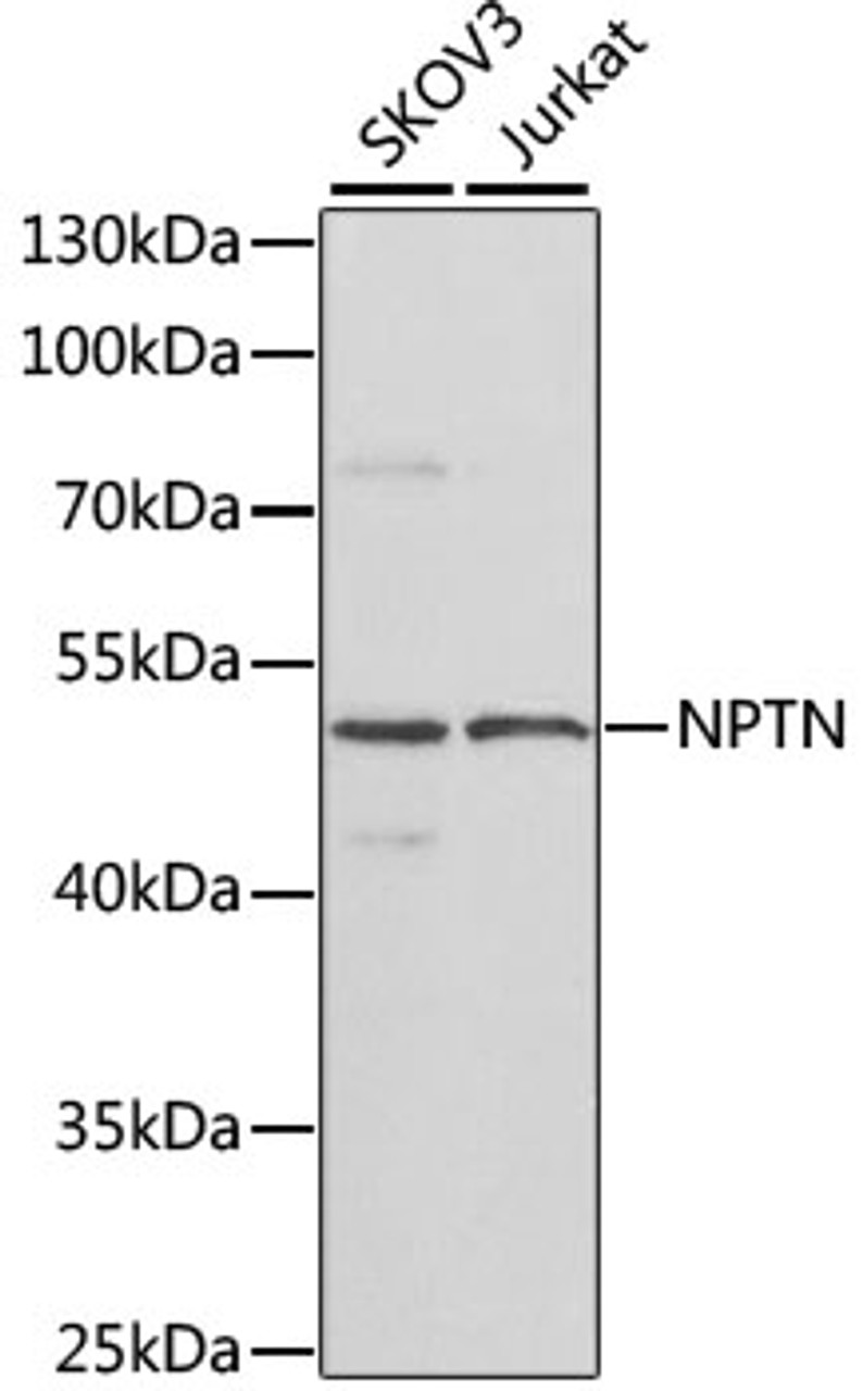 Western blot analysis of extracts of various cell lines using NPTN Polyclonal Antibody at dilution of 1:1000.