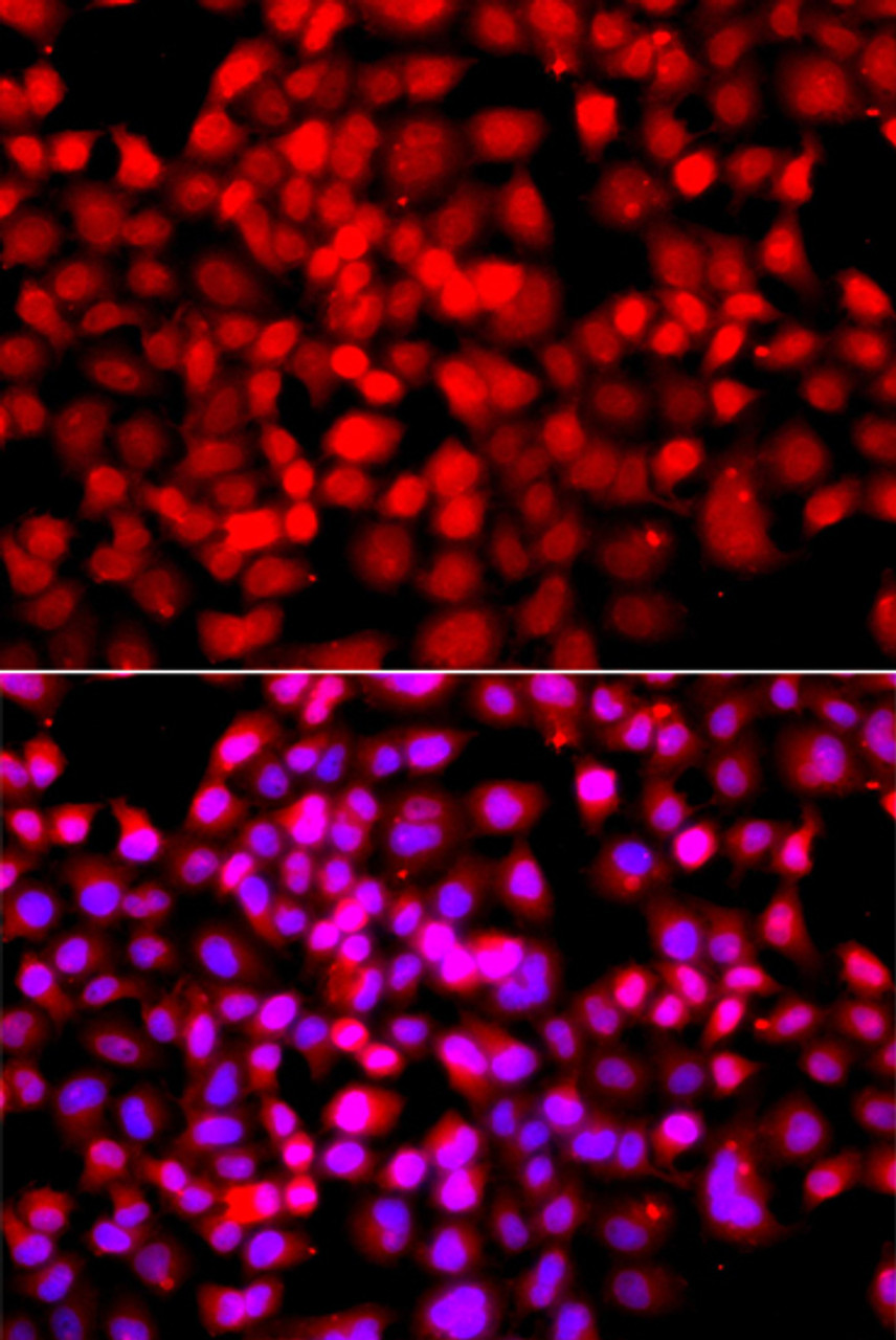 Immunofluorescence analysis of A549 cells using TDP1 Polyclonal Antibody