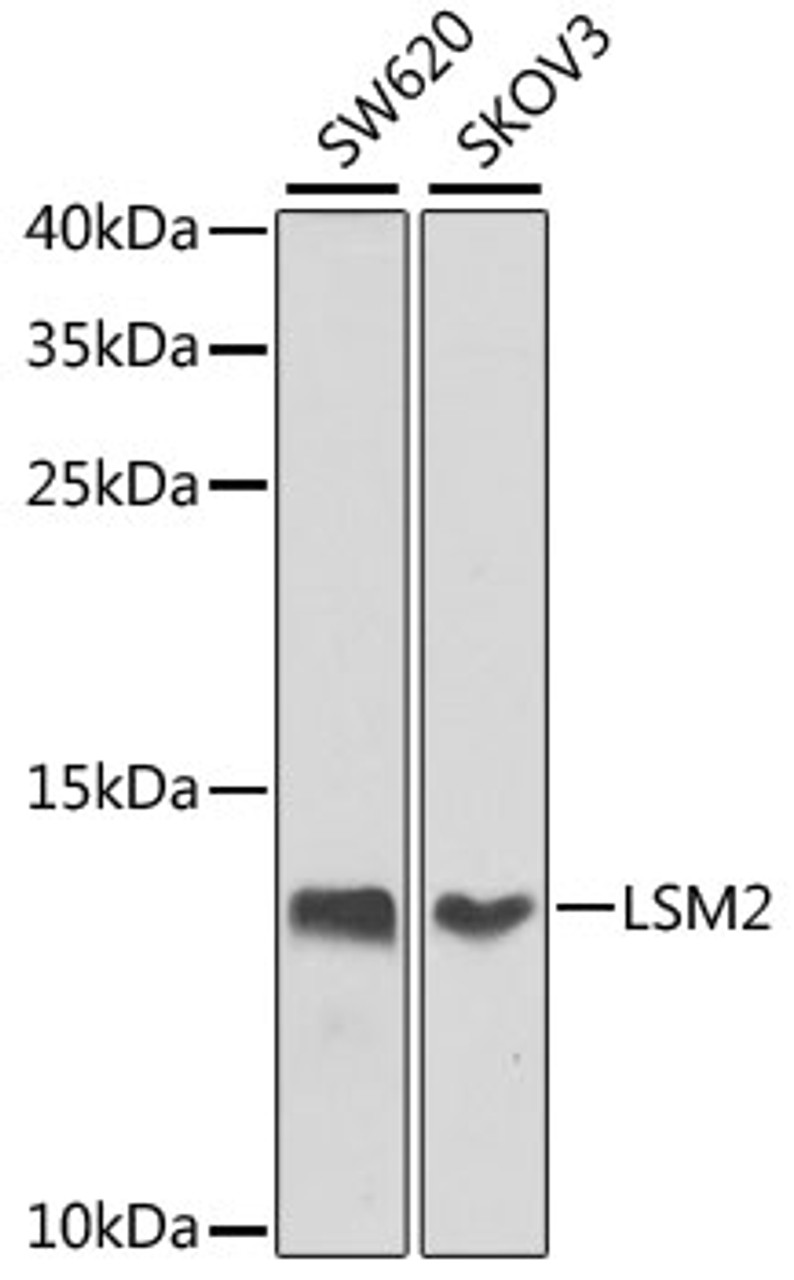 Western blot analysis of extracts of various cell lines using LSM2 Polyclonal Antibody at dilution of 1:1000.