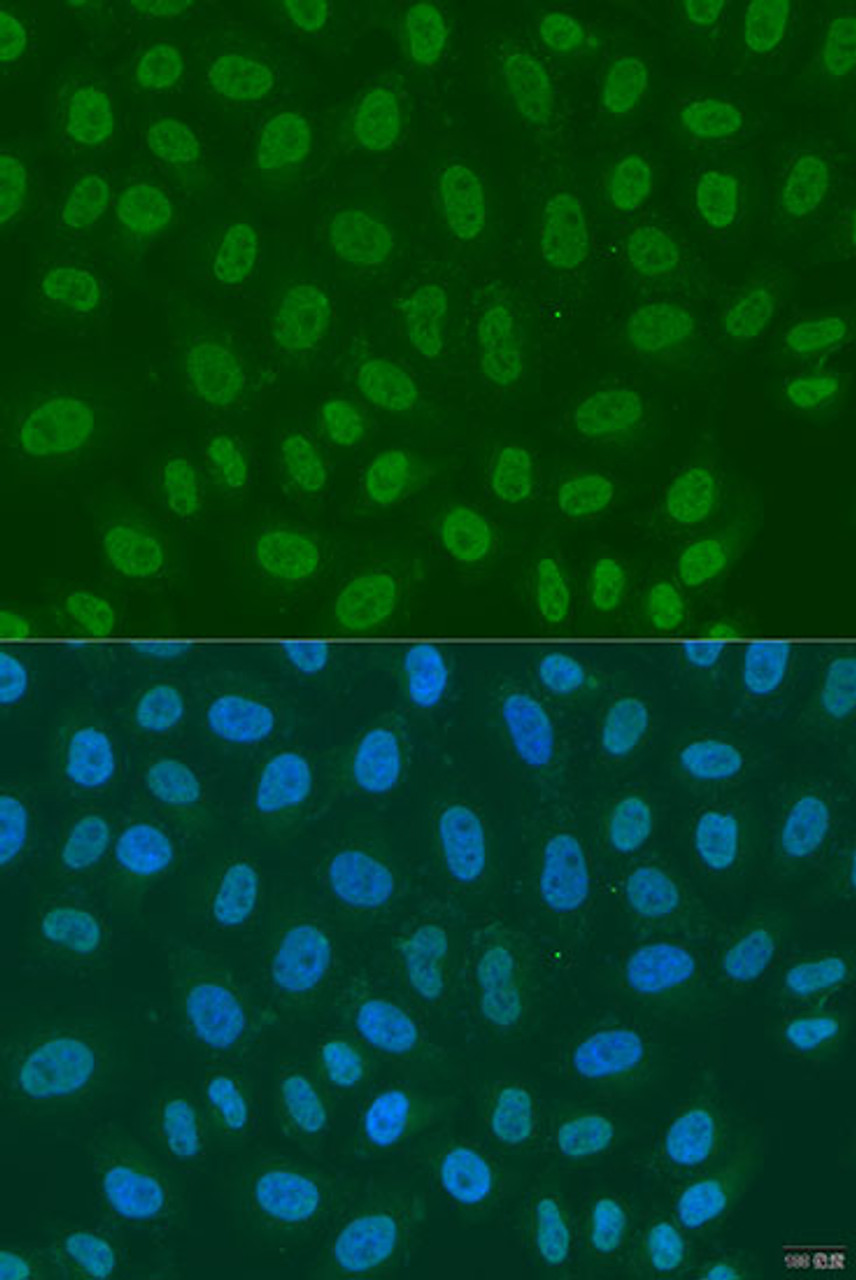 Immunofluorescence analysis of U2OS cells using LSM2 Polyclonal Antibody at dilution of  1:100. Blue: DAPI for nuclear staining.