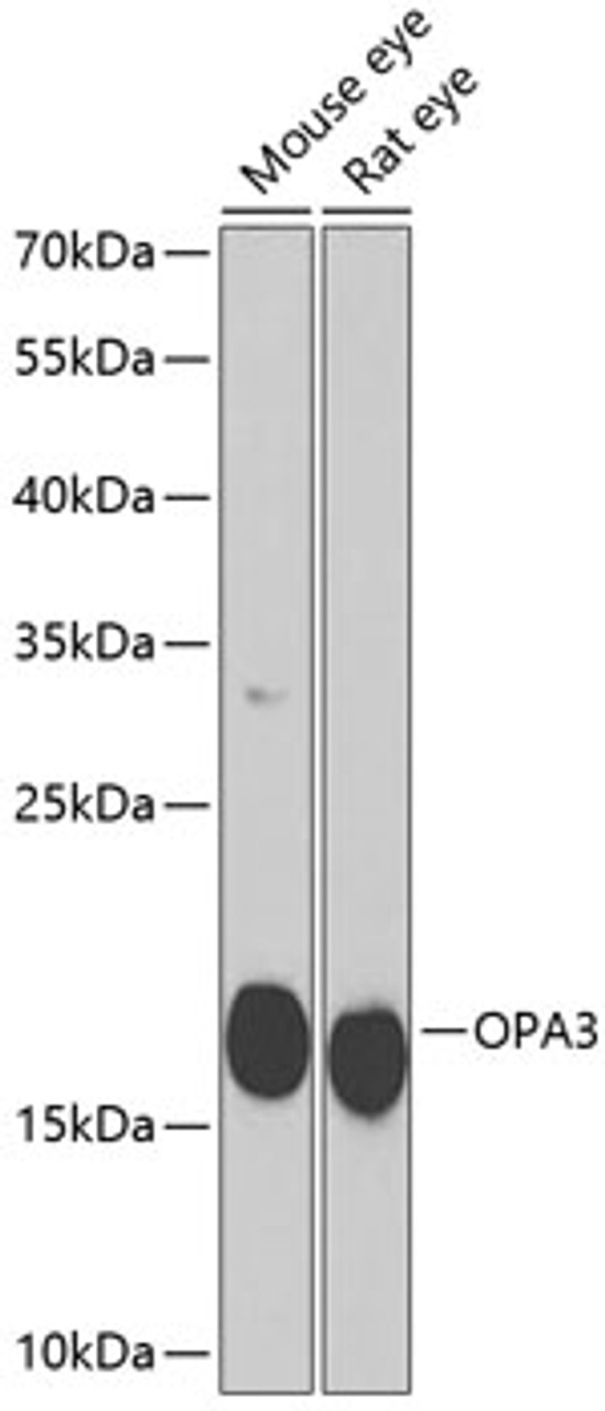 Western blot analysis of extracts of various cell lines using OPA3 Polyclonal Antibody at dilution of 1:1000.