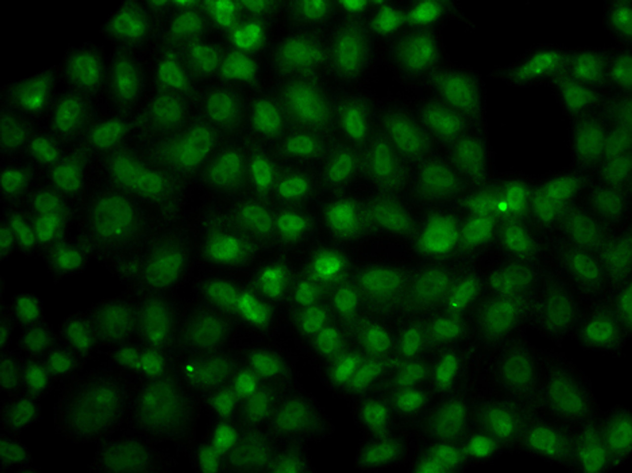 Immunofluorescence analysis of A549 cells using USP26 Polyclonal Antibody