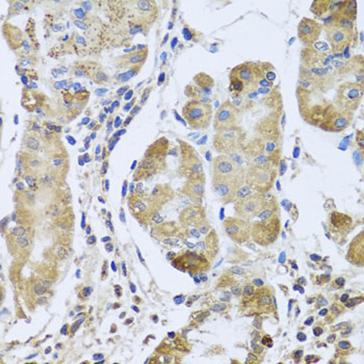 Immunohistochemistry of paraffin-embedded Human stomach using EFHC1 Polyclonal Antibody at dilution of  1:100 (40x lens).