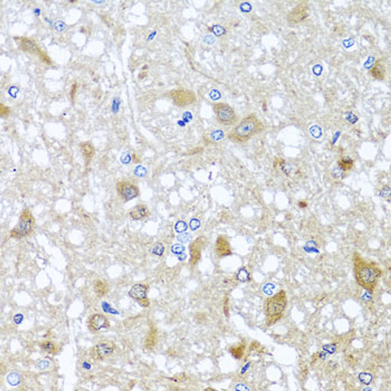 Immunohistochemistry of paraffin-embedded Rat brain using EFHC1 Polyclonal Antibody at dilution of  1:100 (40x lens).