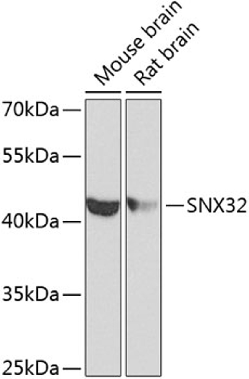 Western blot analysis of extracts of various cell lines using SNX32 Polyclonal Antibody at dilution of 1:1000.