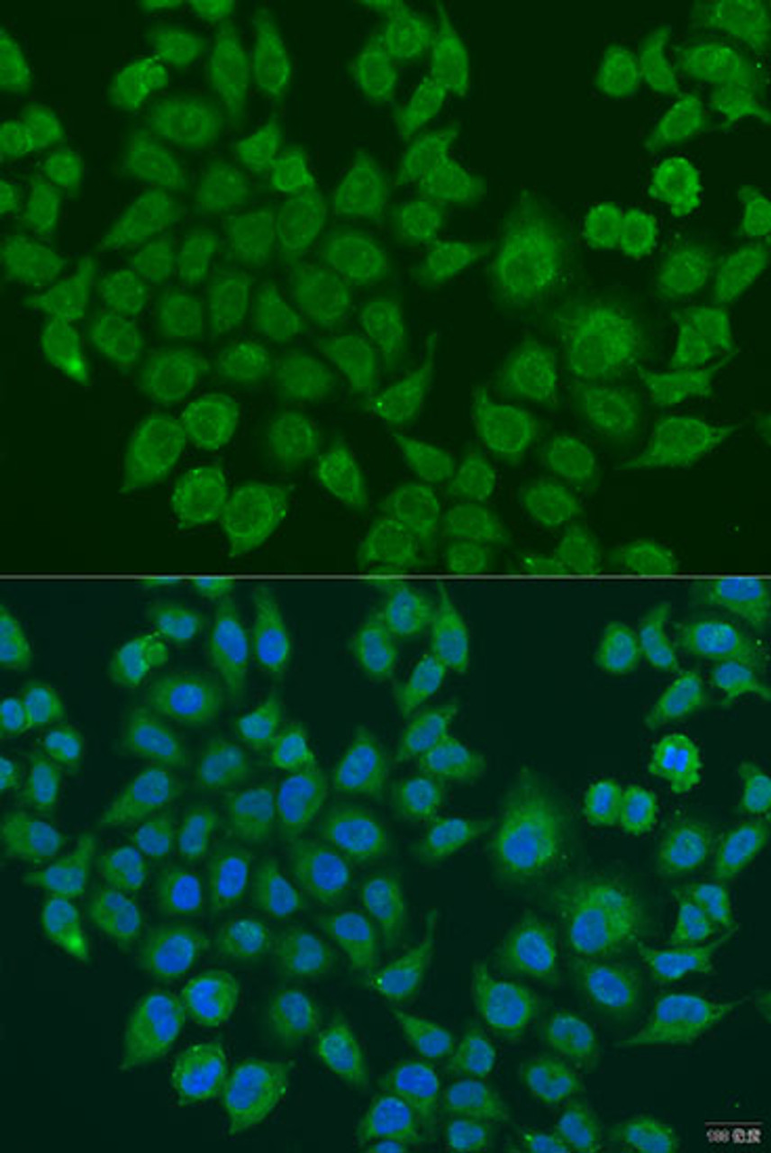 Immunofluorescence analysis of U2OS cells using BLOC1S2 Polyclonal Antibody at dilution of  1:100. Blue: DAPI for nuclear staining.