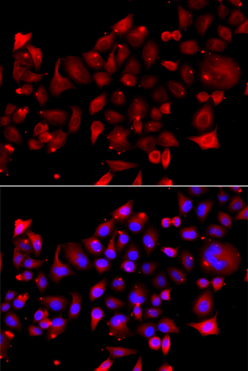 Immunofluorescence analysis of A549 cells using RRM2B Polyclonal Antibody