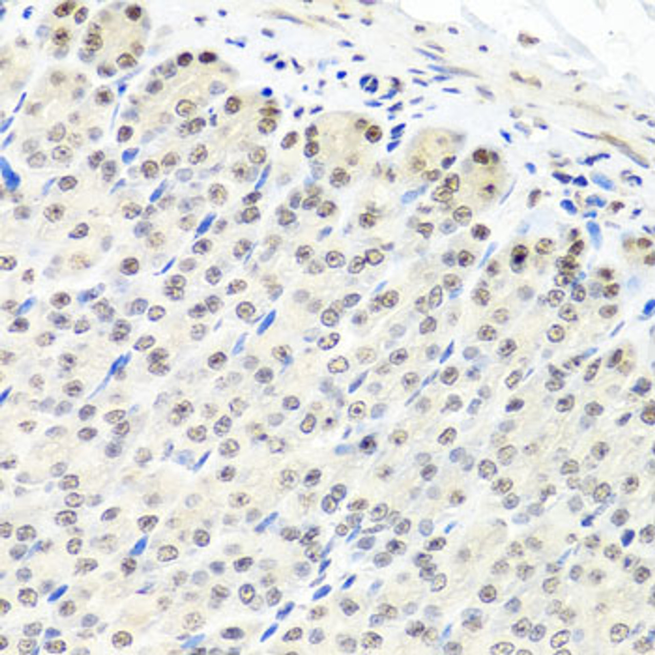 Immunohistochemistry of paraffin-embedded Mouse stomach using CNOT8 Polyclonal Antibody at dilution of  1:100 (40x lens).