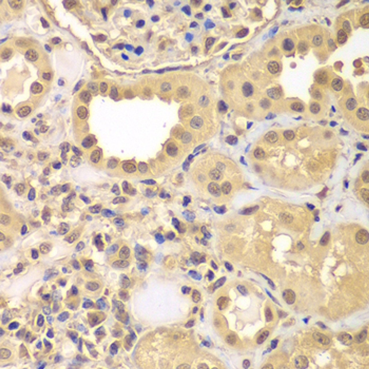 Immunohistochemistry of paraffin-embedded Human kidney using ARNT2 Polyclonal Antibody at dilution of  1:100 (40x lens).