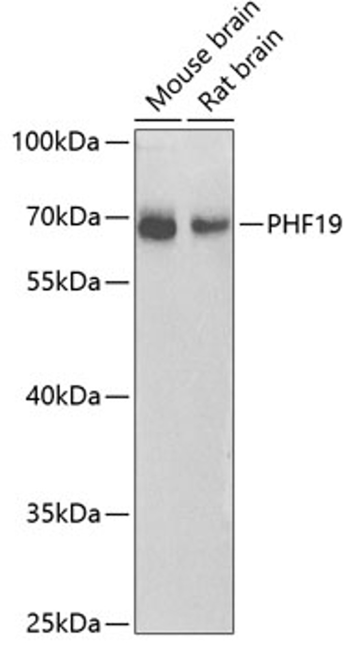 Western blot analysis of extracts of various cell lines using PHF19 Polyclonal Antibody at dilution of 1:1000.