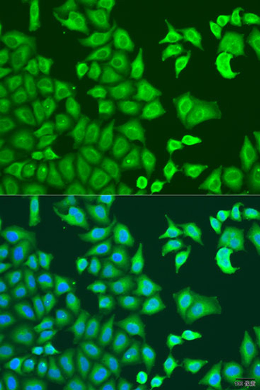 Immunofluorescence analysis of U2OS cells using CAPZB Polyclonal Antibody at dilution of  1:100. Blue: DAPI for nuclear staining.