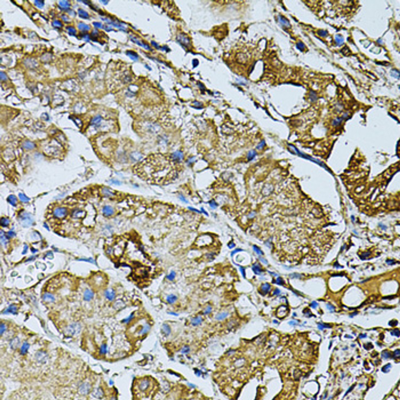 Immunohistochemistry of paraffin-embedded Human stomach using CDH6 Polyclonal Antibody at dilution of  1:100 (40x lens).