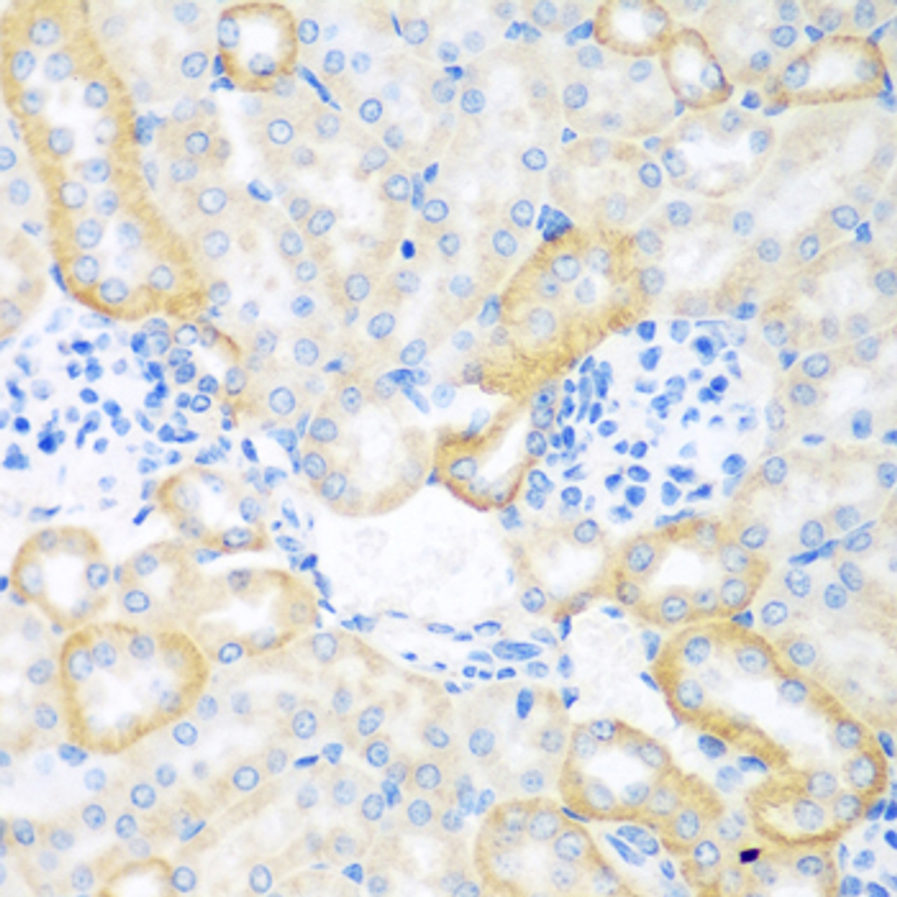 Immunohistochemistry of paraffin-embedded Mouse kidney using CEACAM7 Polyclonal Antibody at dilution of  1:100 (40x lens).
