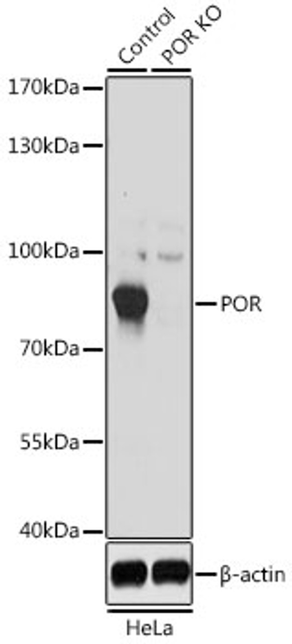 Western blot analysis of extracts from normal (control) and POR knockout (KO) HeLa cells using POR Polyclonal Antibody at dilution of 1:1000.