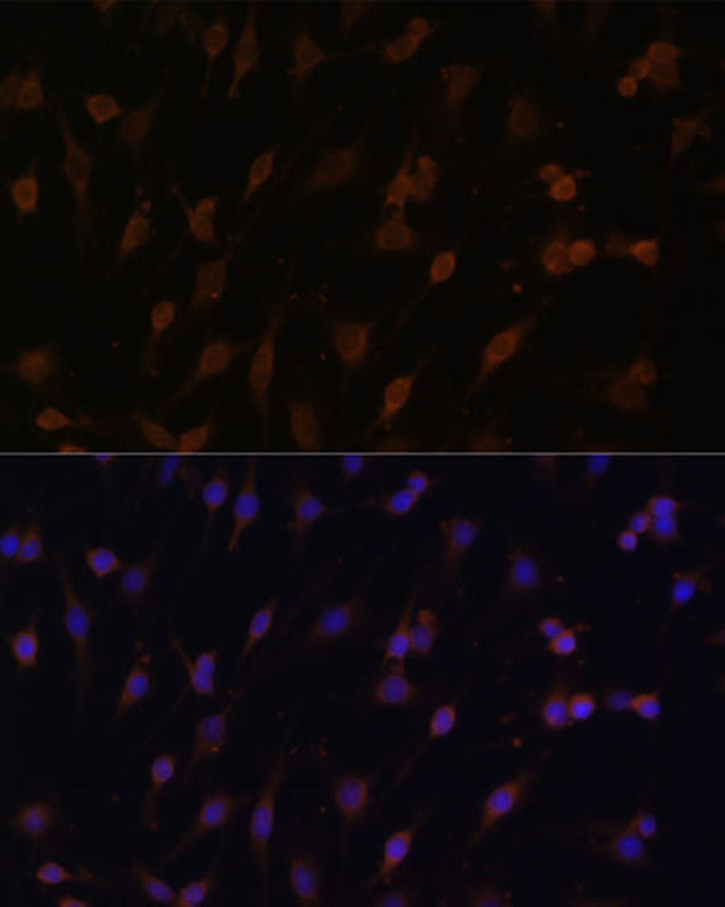 Immunofluorescence analysis of C6 cells using POR Polyclonal Antibody at dilution of  1:100 (40x lens). Blue: DAPI for nuclear staining.