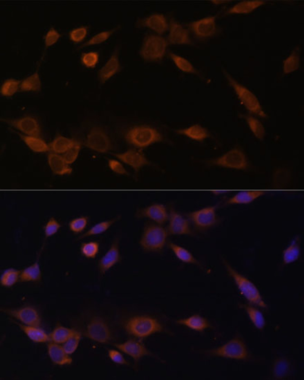 Immunofluorescence analysis of NIH-3T3 cells using POR Polyclonal Antibody at dilution of  1:100 (40x lens). Blue: DAPI for nuclear staining.