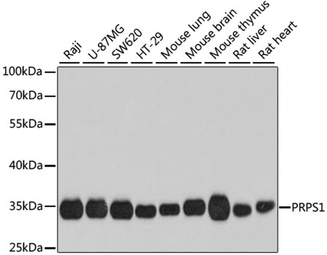 Western blot analysis of extracts of various cell lines using PRPS1 Polyclonal Antibody at dilution of 1:1000.