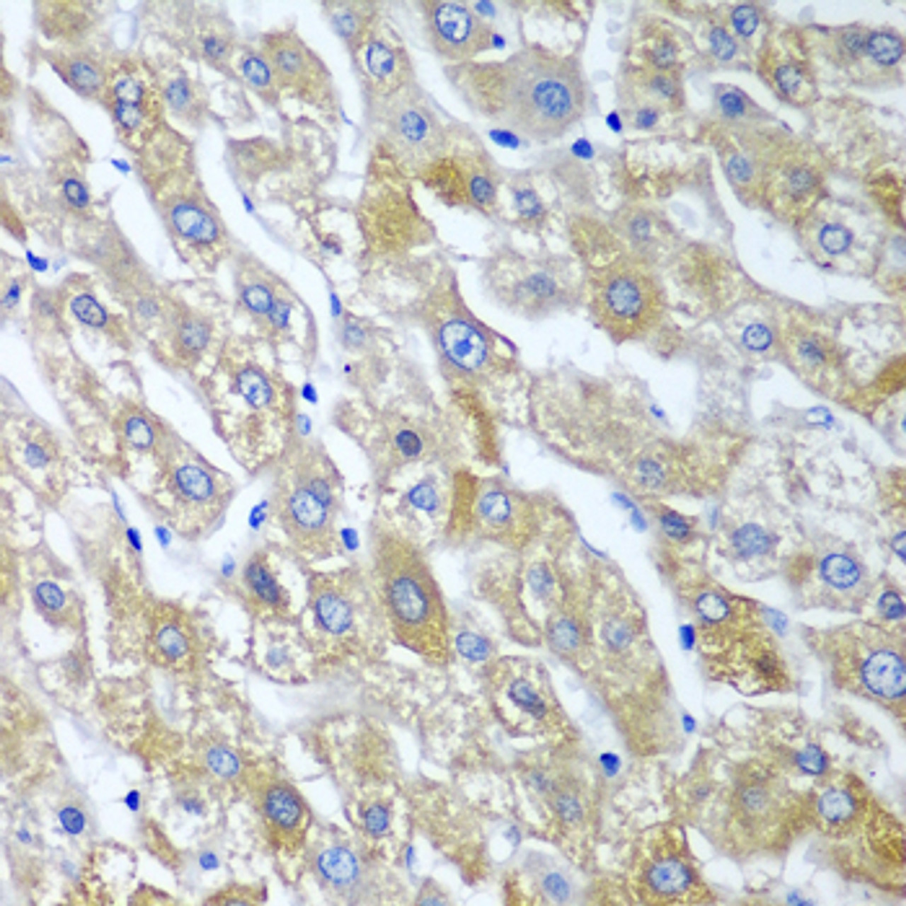 Immunohistochemistry of paraffin-embedded Human liver using SGSH Polyclonal Antibody at dilution of  1:100 (40x lens).