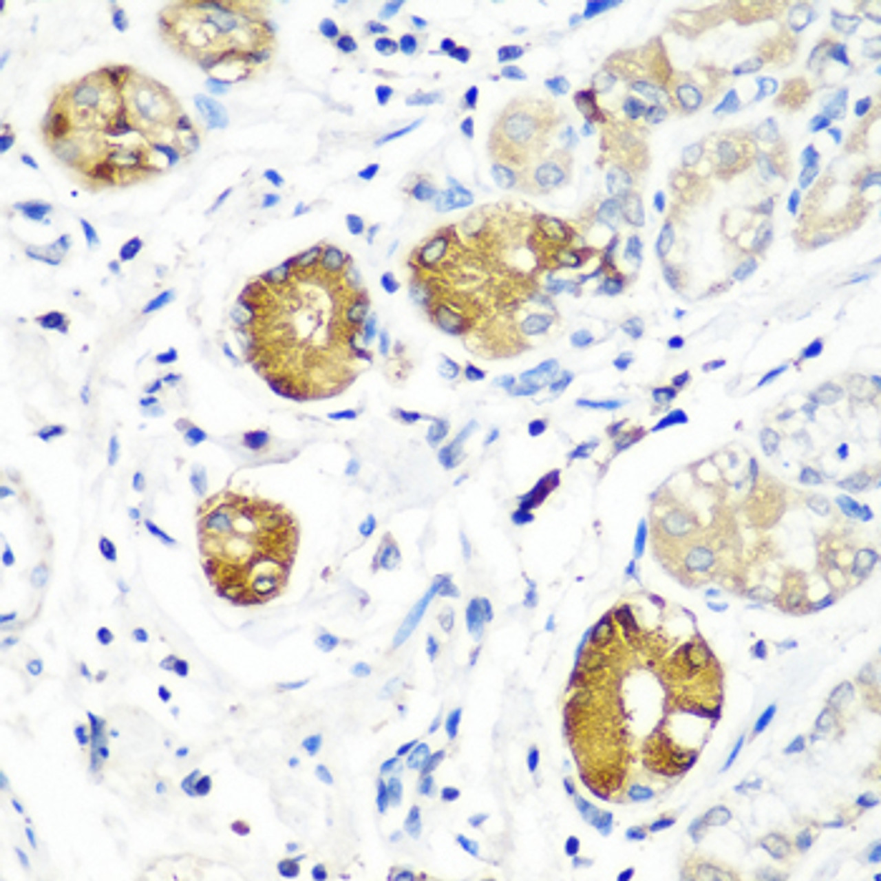 Immunohistochemistry of paraffin-embedded Human stomach using SGSH Polyclonal Antibody at dilution of  1:100 (40x lens).