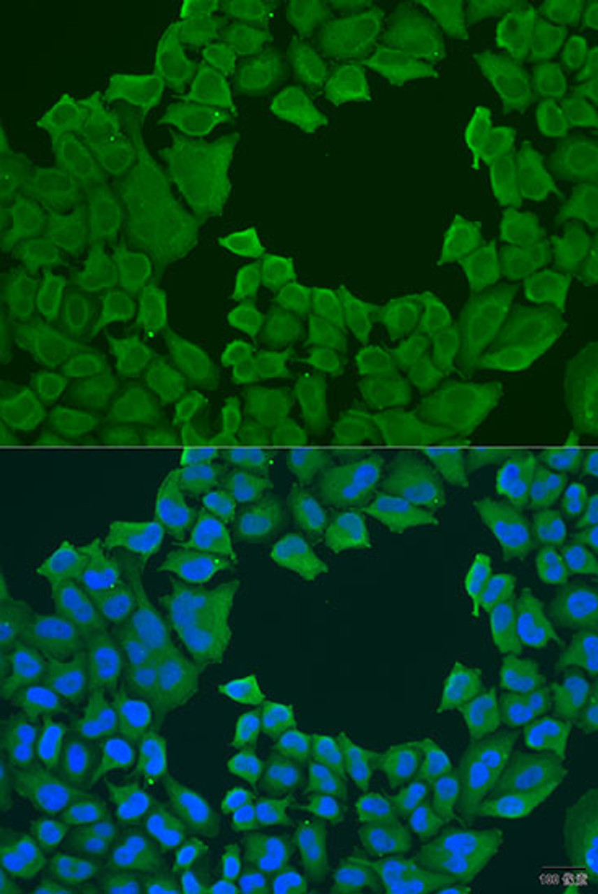 Immunofluorescence analysis of U2OS cells using STXBP3 Polyclonal Antibody at dilution of  1:100. Blue: DAPI for nuclear staining.