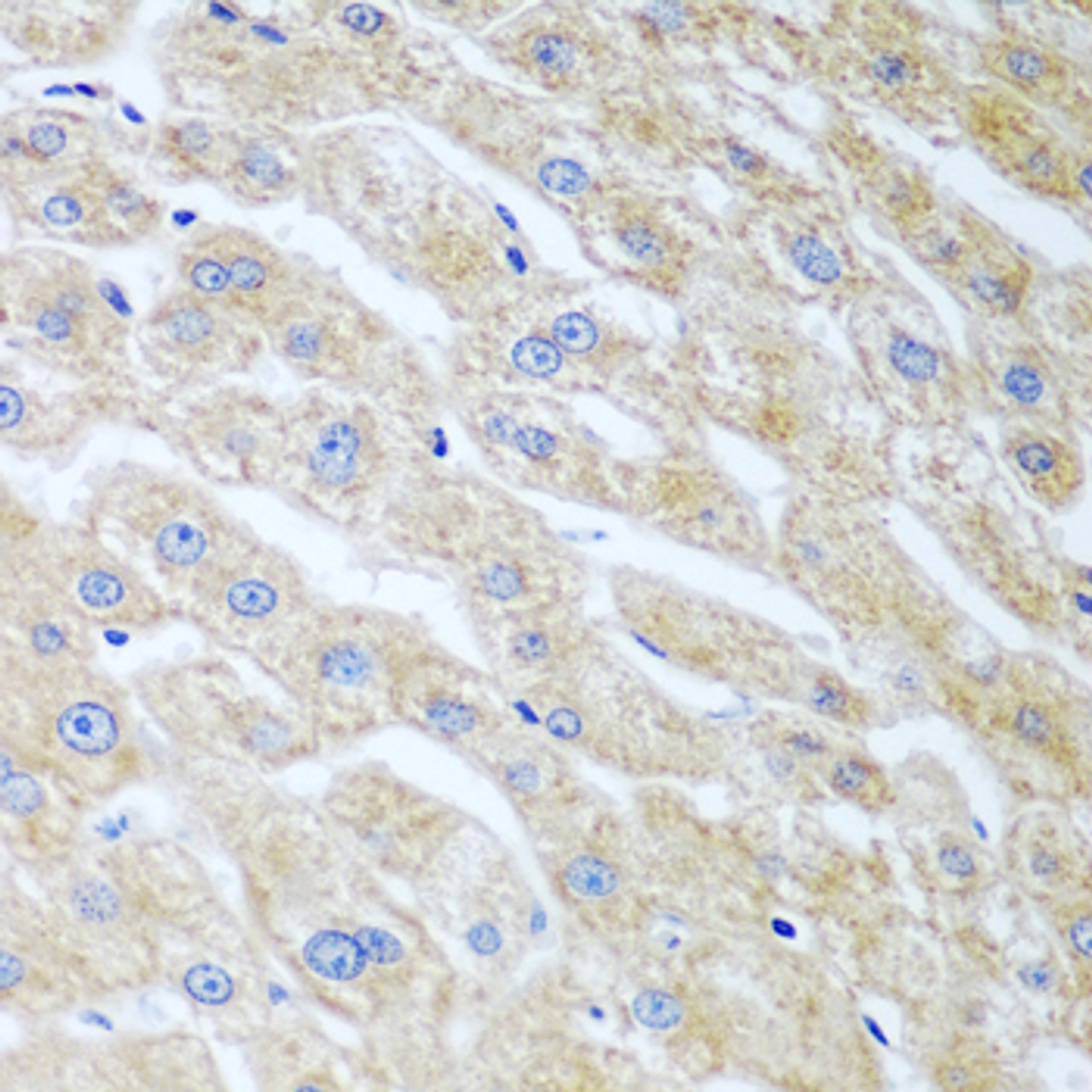 Immunohistochemistry of paraffin-embedded Human liver using UCHL3 Polyclonal Antibody at dilution of  1:100 (40x lens).