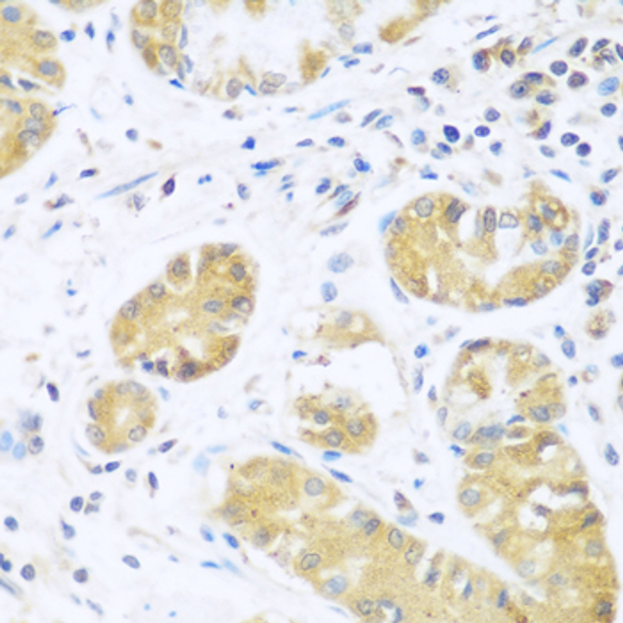 Immunohistochemistry of paraffin-embedded Human stomach using UCHL3 Polyclonal Antibody at dilution of  1:100 (40x lens).