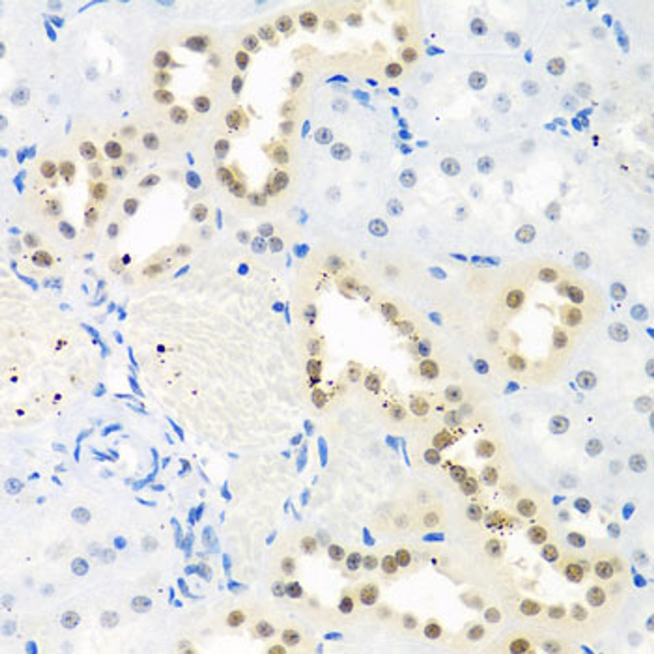 Immunohistochemistry of paraffin-embedded Rat kidney using THOC1 Polyclonal Antibody at dilution of  1:100 (40x lens).