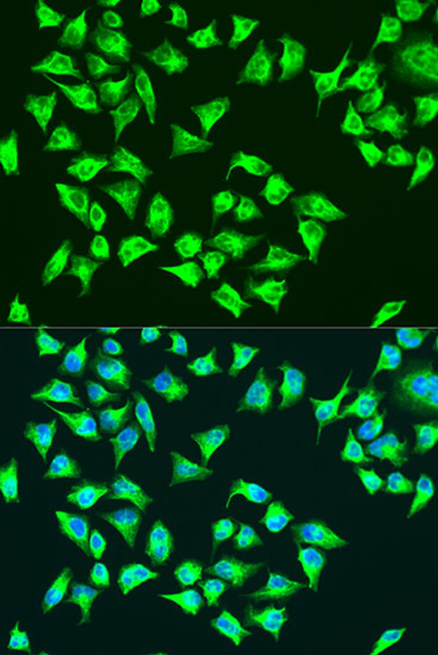Immunofluorescence analysis of U2OS cells using ATP6 Polyclonal Antibody at dilution of  1:100. Blue: DAPI for nuclear staining.