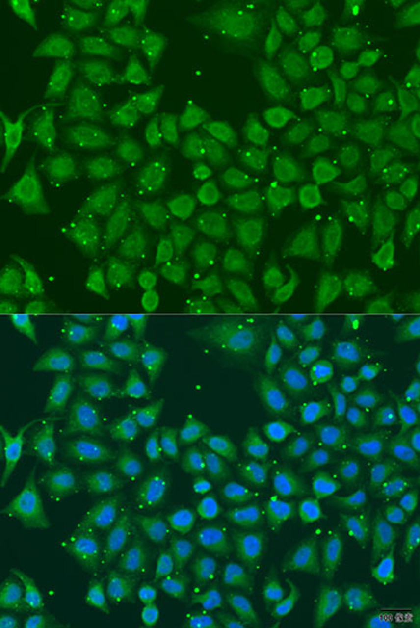 Immunofluorescence analysis of U2OS cells using AKR7A3 Polyclonal Antibody at dilution of  1:100. Blue: DAPI for nuclear staining.