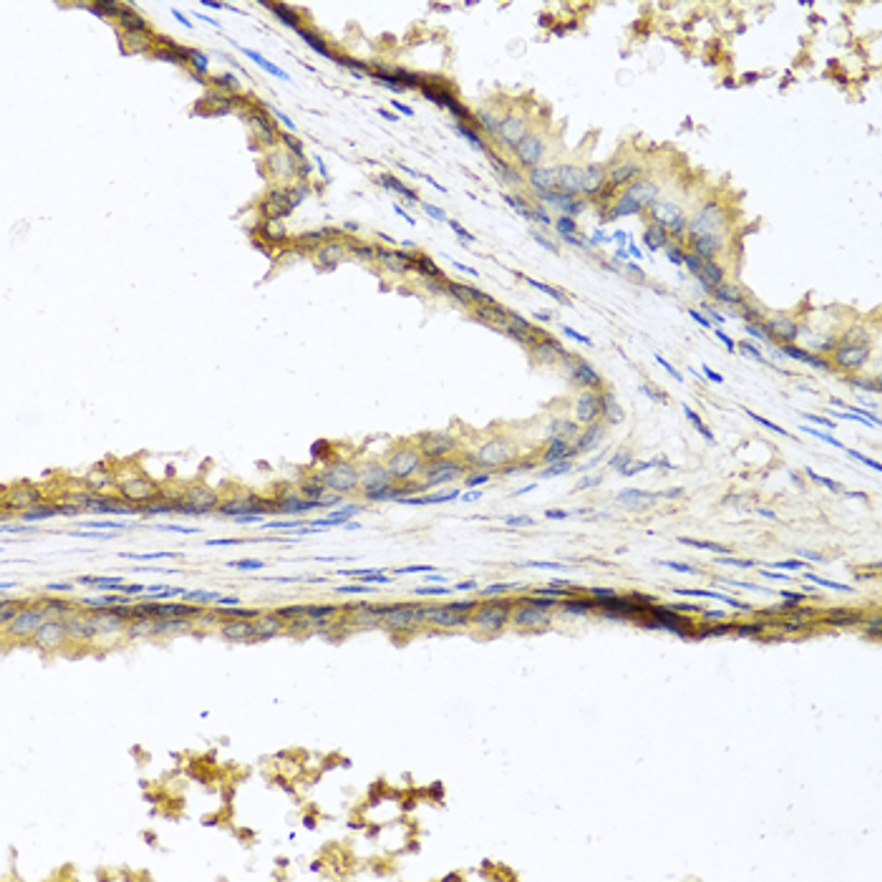 Immunohistochemistry of paraffin-embedded Human prostate using SOST Polyclonal Antibody at dilution of  1:100 (40x lens).