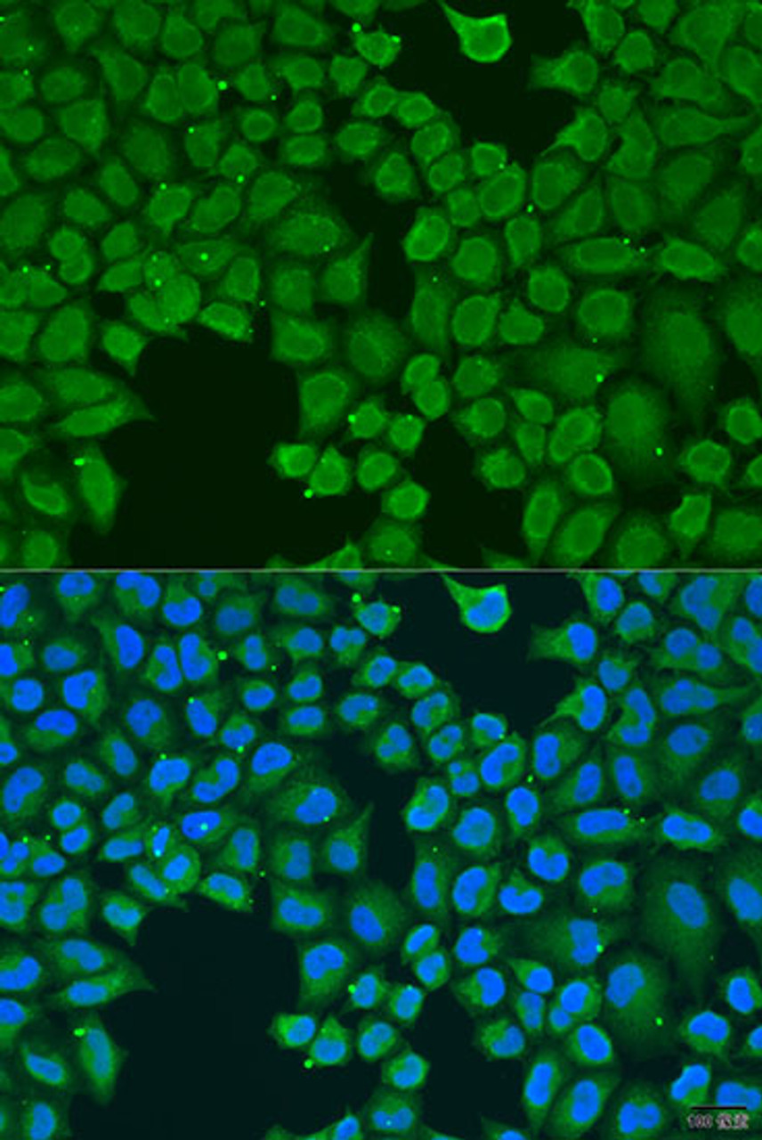 Immunofluorescence analysis of U2OS cells using AGGF1 Polyclonal Antibody at dilution of  1:100. Blue: DAPI for nuclear staining.