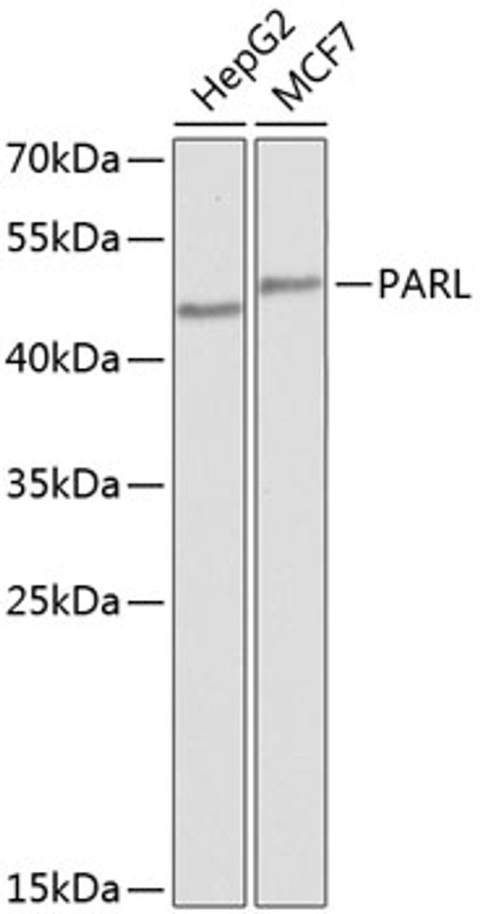 Western blot analysis of extracts of various cell lines using PARL Polyclonal Antibody at dilution of 1:1000.