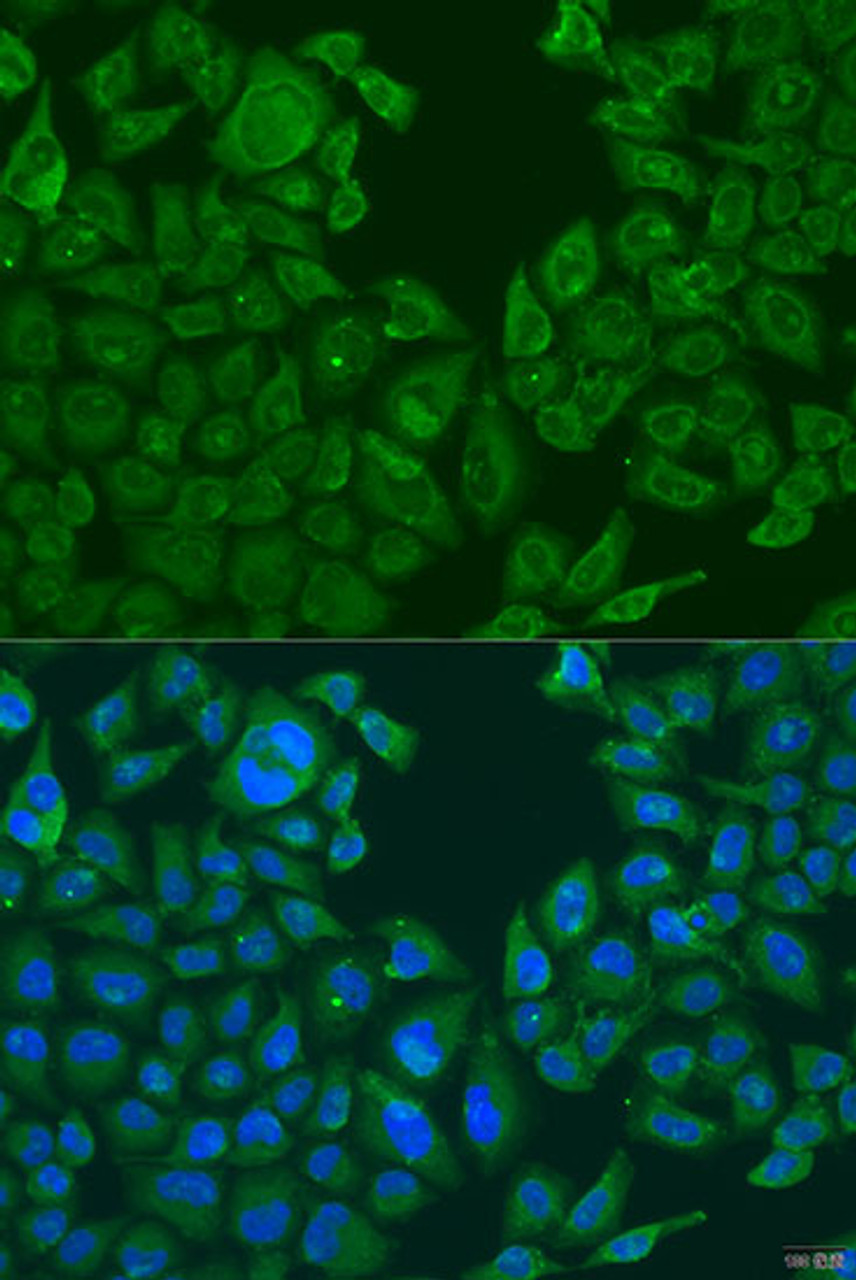 Immunofluorescence analysis of U2OS cells using NLRP2 Polyclonal Antibody at dilution of  1:100. Blue: DAPI for nuclear staining.
