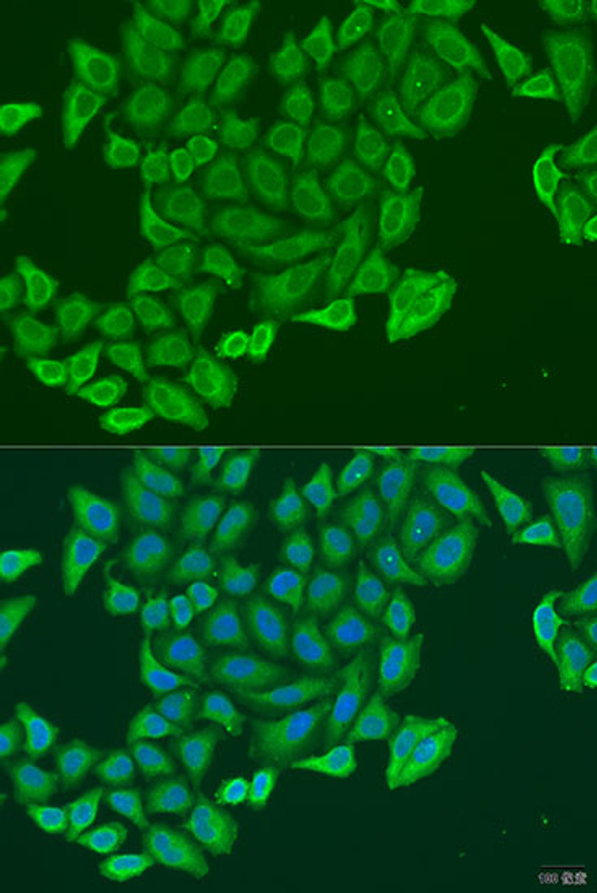 Immunofluorescence analysis of U2OS cells using EXOC2 Polyclonal Antibody at dilution of  1:100. Blue: DAPI for nuclear staining.