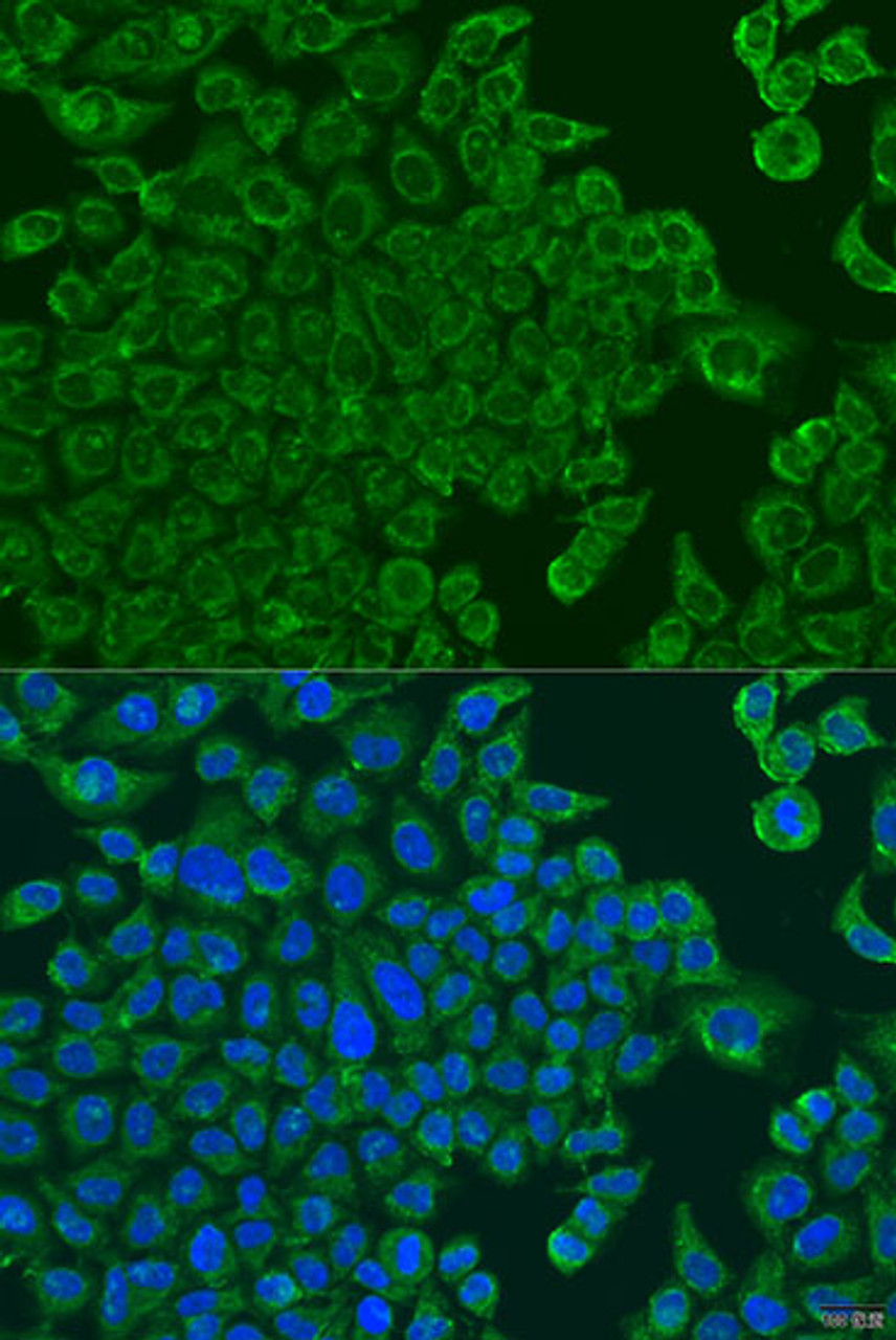Immunofluorescence analysis of U2OS cells using ALOXE3 Polyclonal Antibody at dilution of  1:100. Blue: DAPI for nuclear staining.