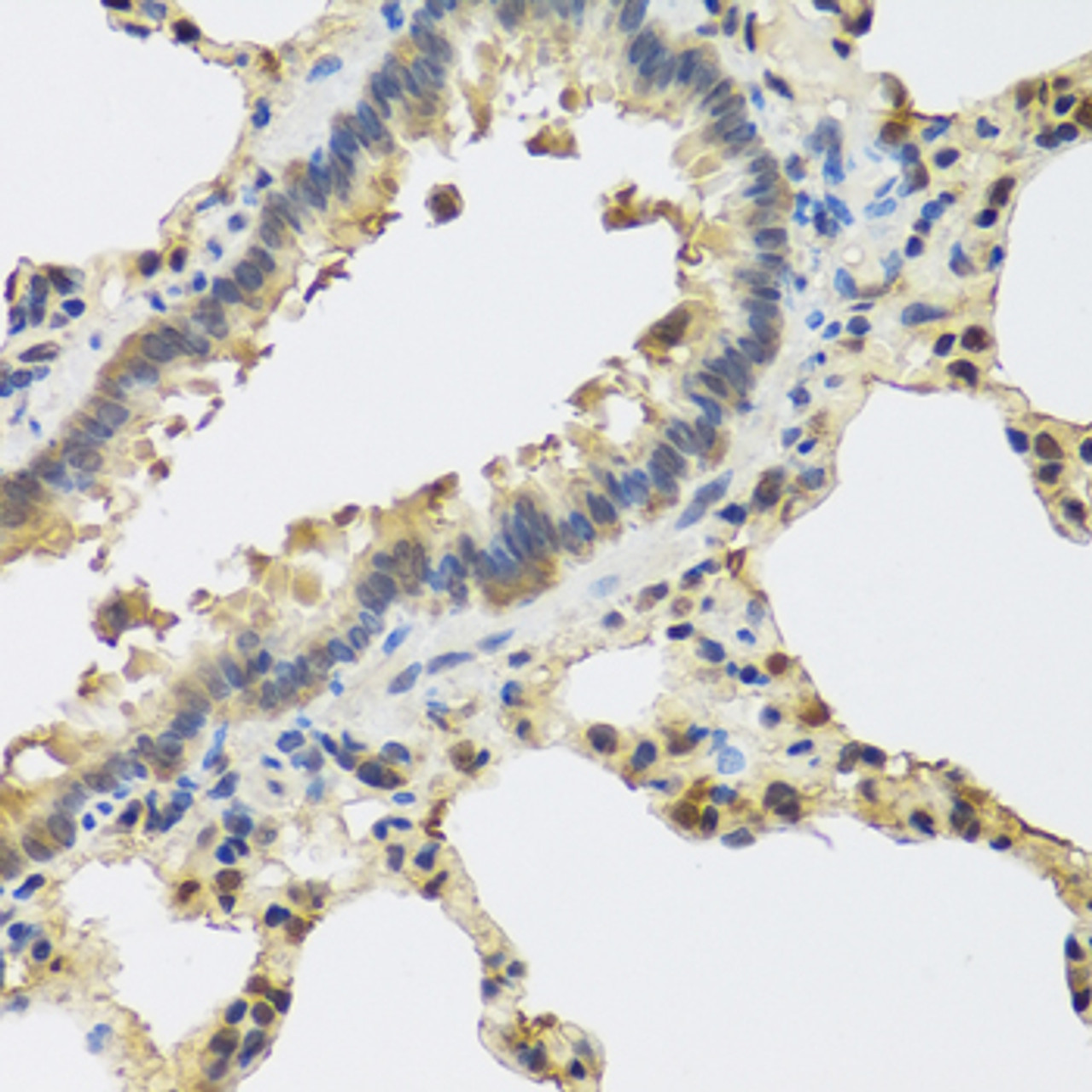 Immunohistochemistry of paraffin-embedded Rat lung using IL25 Polyclonal Antibody at dilution of  1:100 (40x lens).