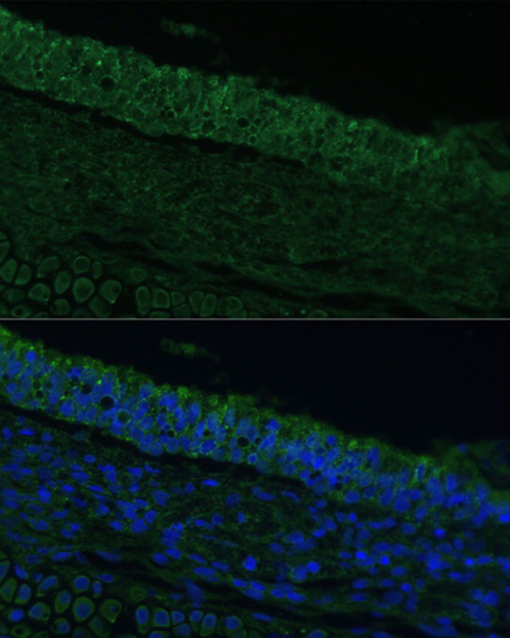 Immunofluorescence analysis of Rat bronchus cells using IL25 Polyclonal Antibody at dilution of  1:100. Blue: DAPI for nuclear staining.