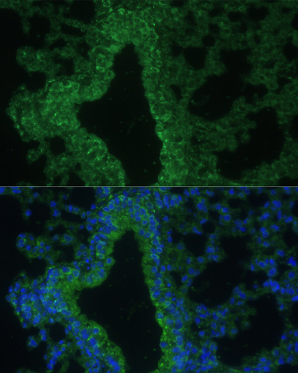 Immunofluorescence analysis of Mouse lung cells using IL25 Polyclonal Antibody at dilution of  1:100. Blue: DAPI for nuclear staining.