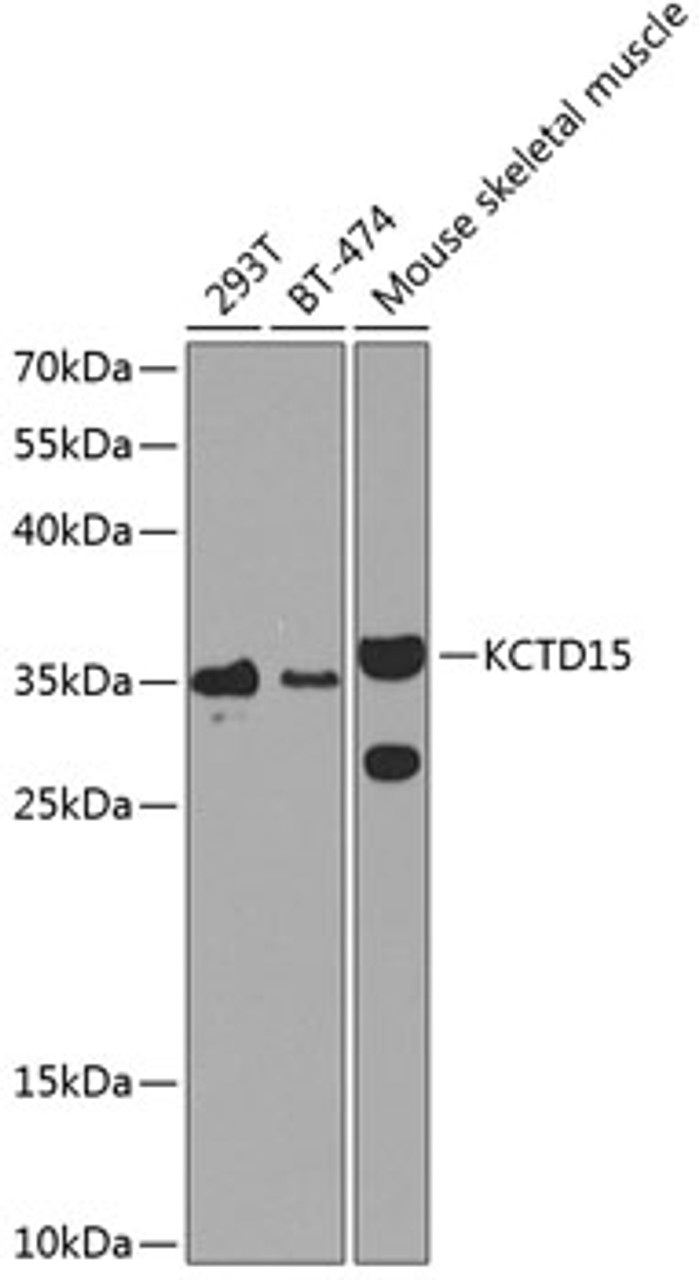 Western blot analysis of extracts of various cell lines using KCTD15 Polyclonal Antibody at dilution of 1:1000.