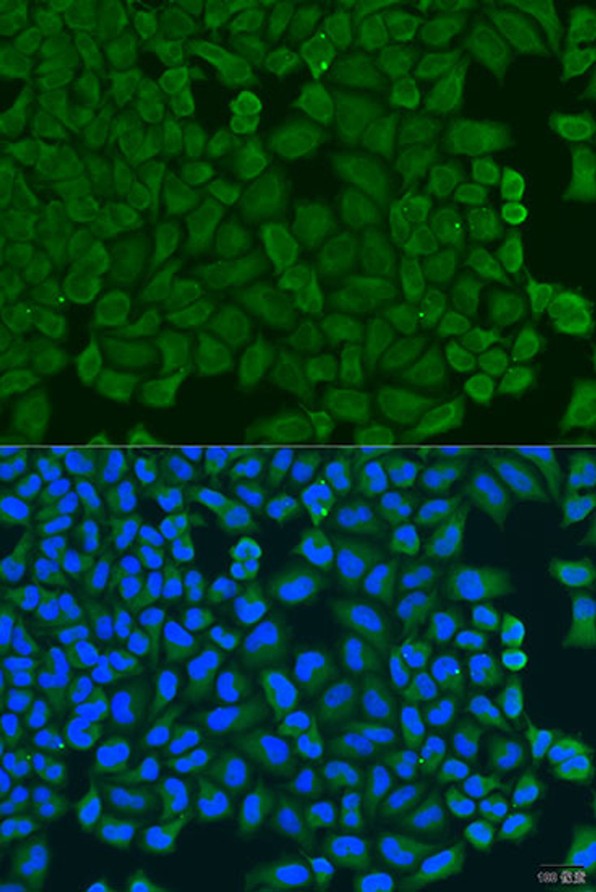 Immunofluorescence analysis of U2OS cells using KCTD15 Polyclonal Antibody at dilution of  1:100. Blue: DAPI for nuclear staining.