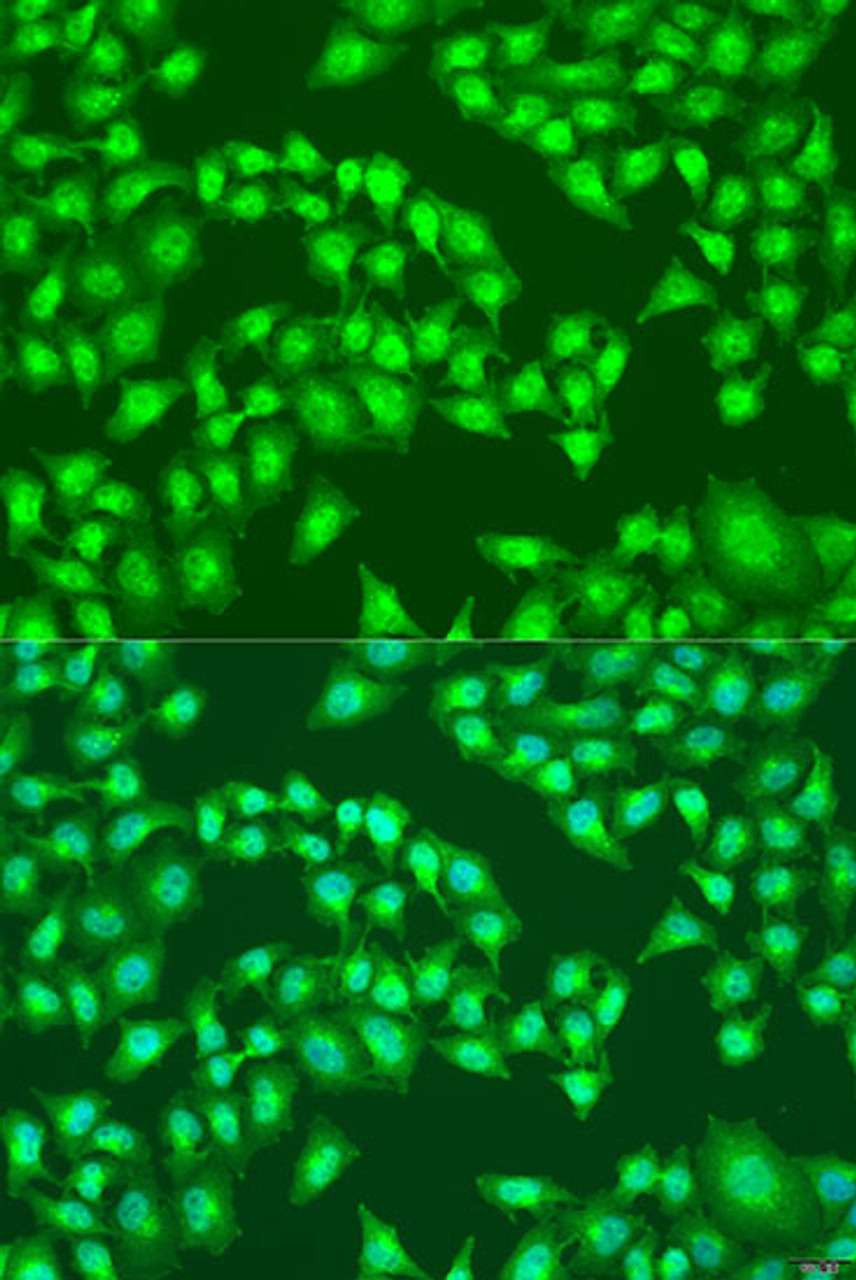 Immunofluorescence analysis of U2OS cells using RSAD2 Polyclonal Antibody at dilution of  1:100. Blue: DAPI for nuclear staining.