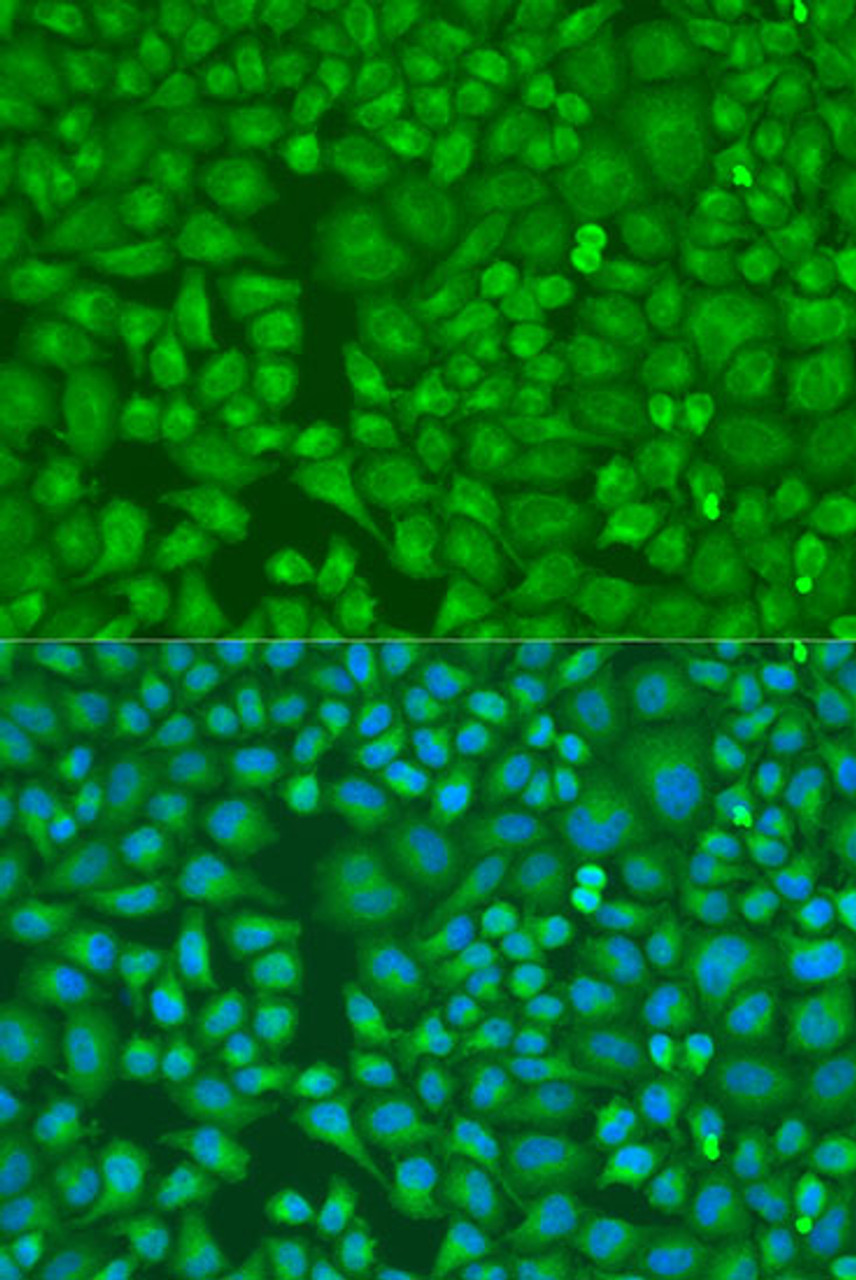 Immunofluorescence analysis of U2OS cells using LLGL2 Polyclonal Antibody at dilution of  1:100. Blue: DAPI for nuclear staining.