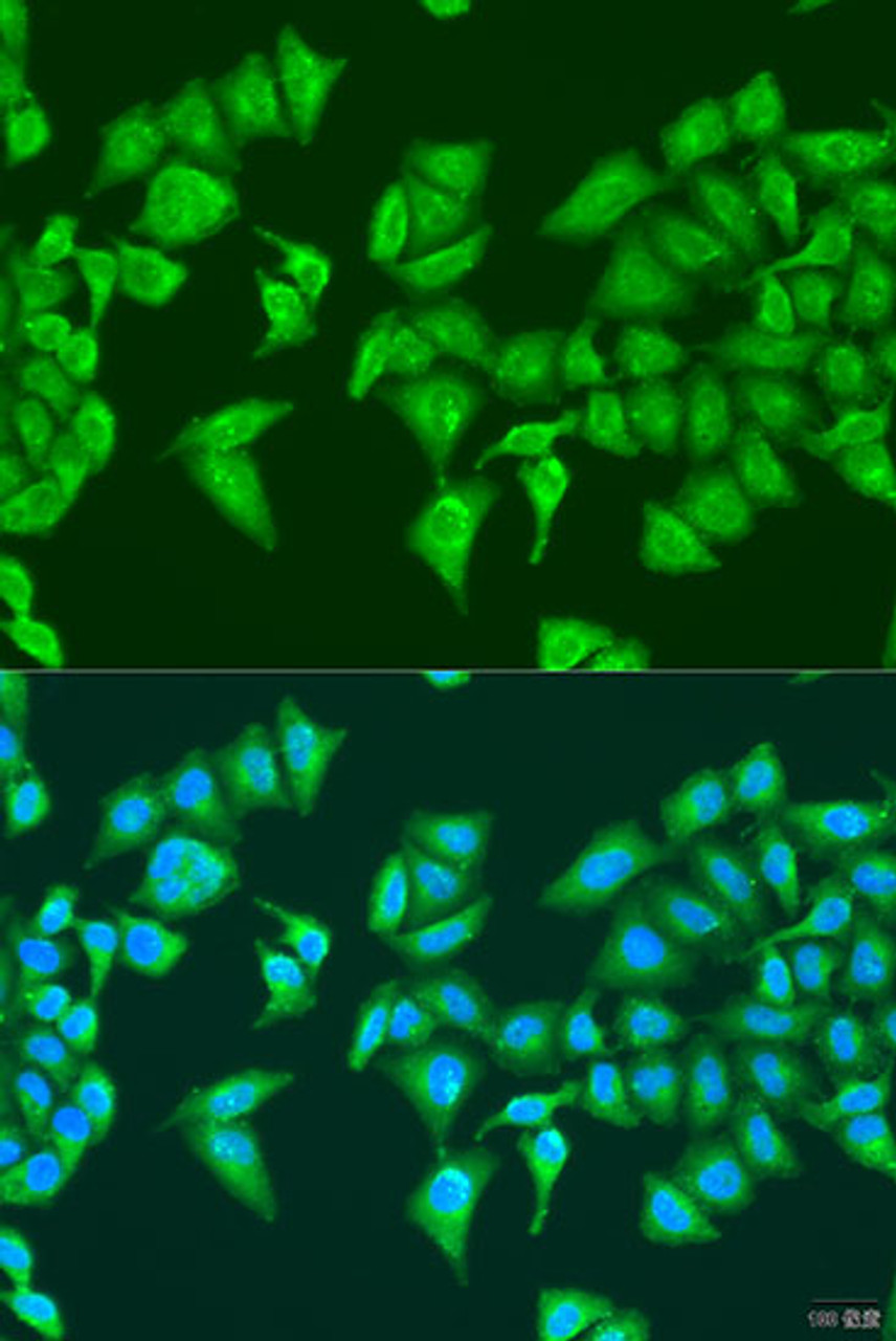 Immunofluorescence analysis of U2OS cells using HYLS1 Polyclonal Antibody at dilution of  1:100. Blue: DAPI for nuclear staining.