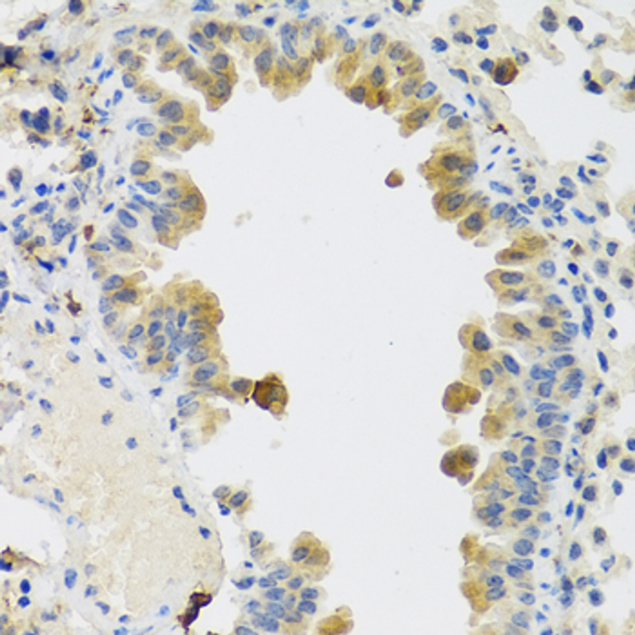 Immunohistochemistry of paraffin-embedded Mouse lung using RSPO1 Polyclonal Antibody at dilution of  1:100 (40x lens).