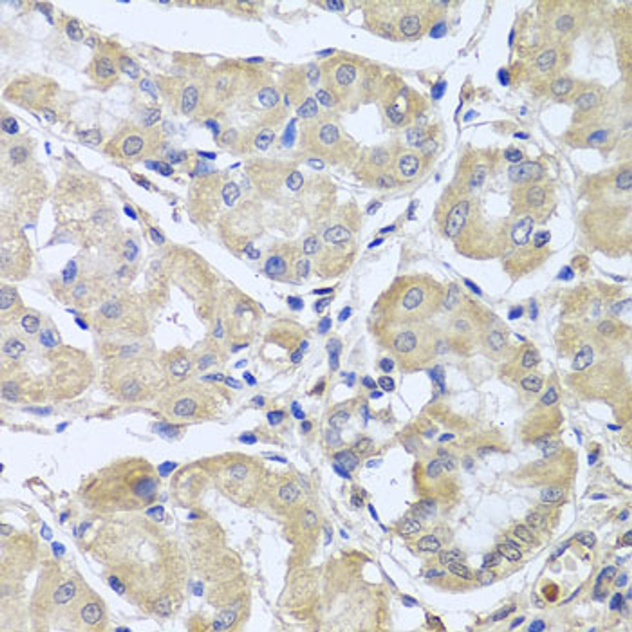 Immunohistochemistry of paraffin-embedded Human stomach using CEP57L1 Polyclonal Antibody at dilution of  1:100 (40x lens).